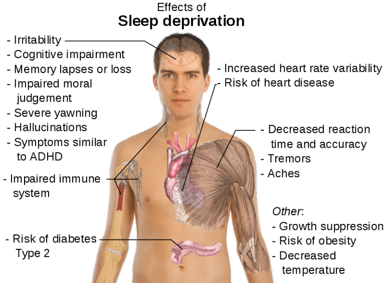 insomnia sleep mental health